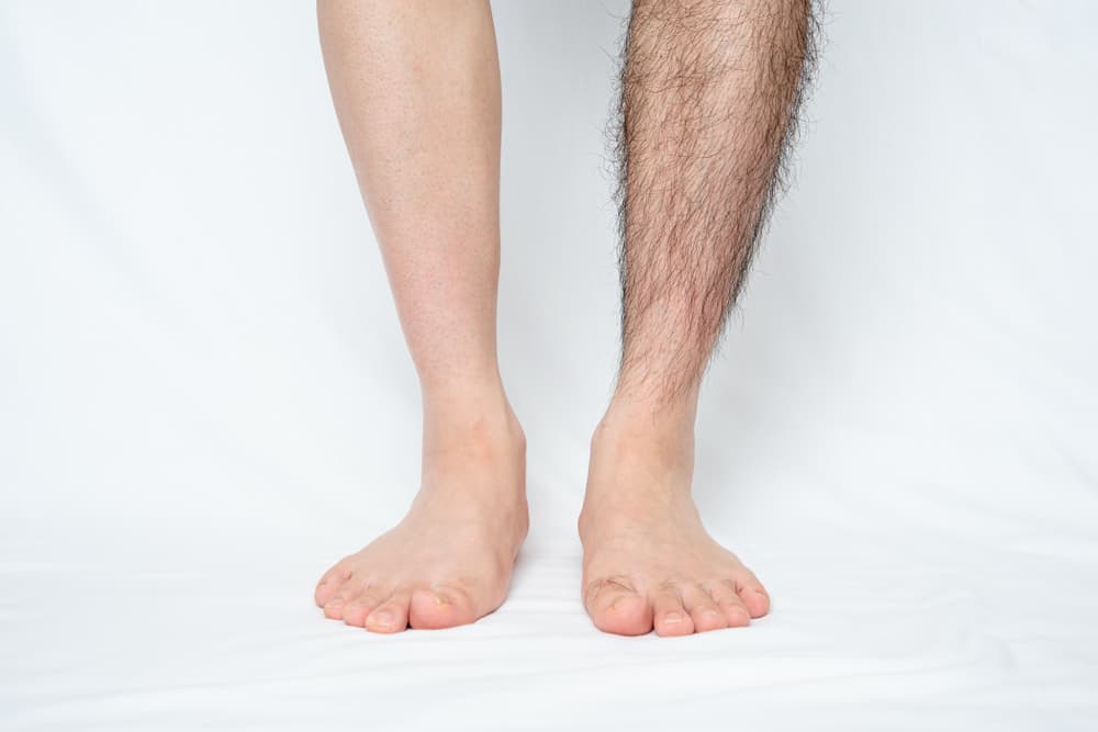 One leg fully waxed and the other natural, showing clear before and after results of a professional men’s leg waxing treatment.