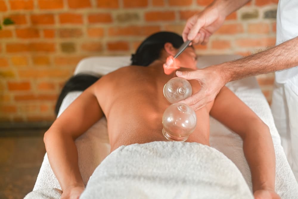 A therapist performing a cupping treatment using glass cups during a deep tissue massage, illustrating the Belabaci Cupping Deep Tissue Massage service.