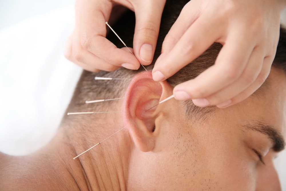 Close-up of a man receiving ear acupuncture therapy in a calm and professional setting in Weston-super-Mare