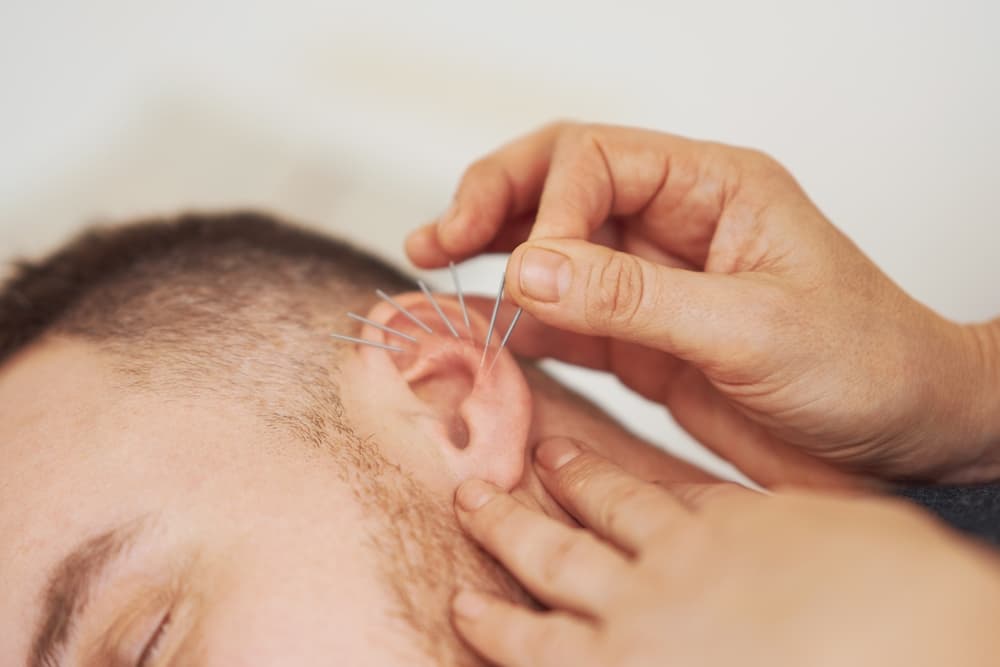 Man receiving ear acupuncture therapy as part of a two-person treatment session in Weston-super-Mare