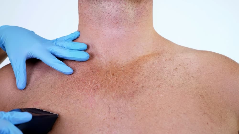 A close-up of a male chest being professionally trimmed by a therapist wearing blue gloves, during a body grooming session in a treatment room.